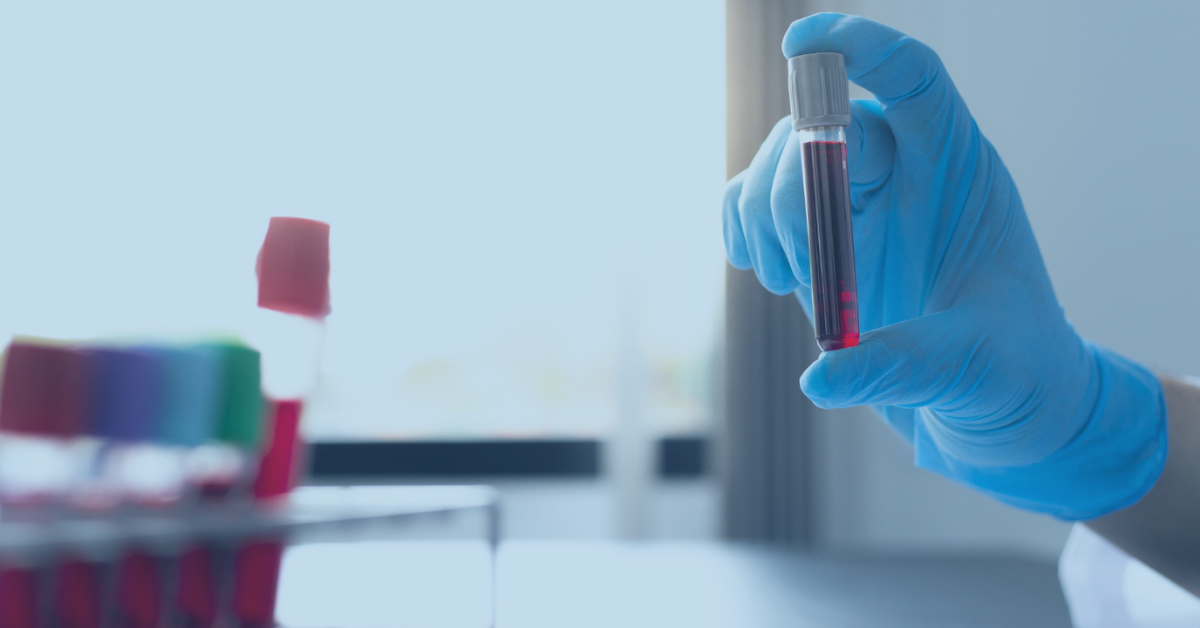 Pregnancy blood test price: 1 Blood Test for Pregnancy Confirmation