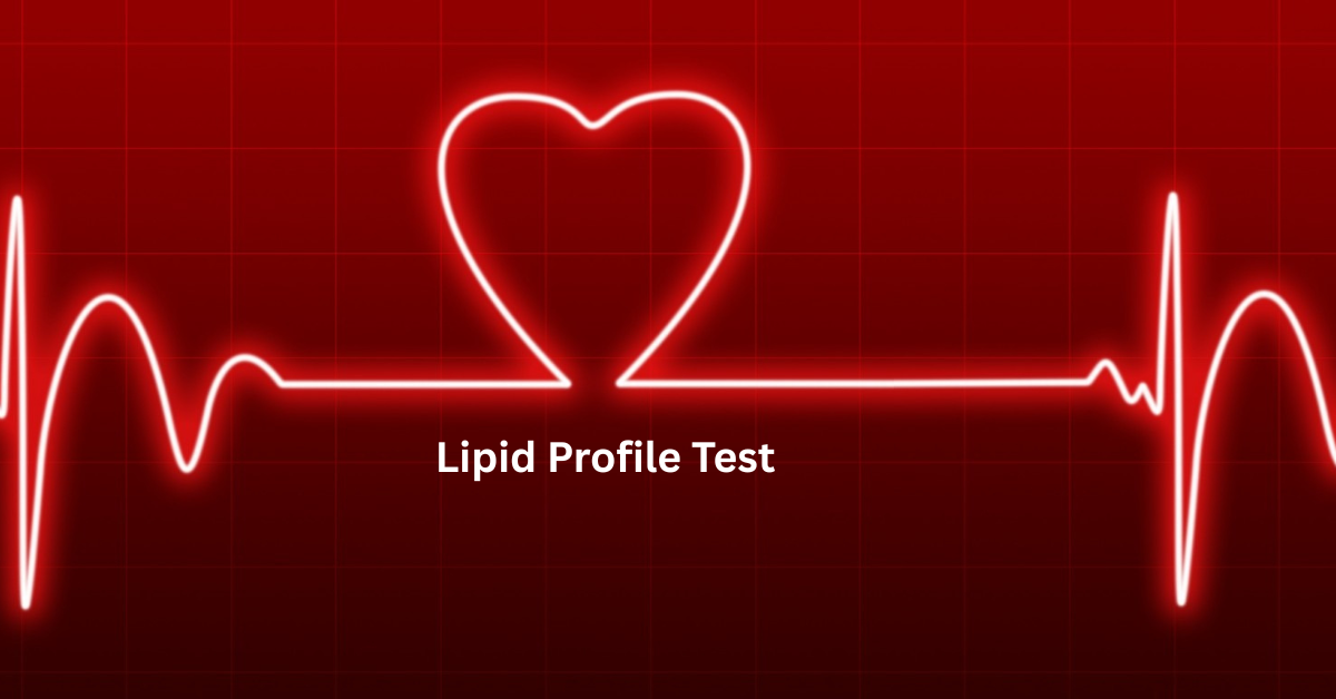 Lipid Profile Test | Why it is important? How Much it cost? When to get it done?
