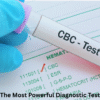 cbc test delhi