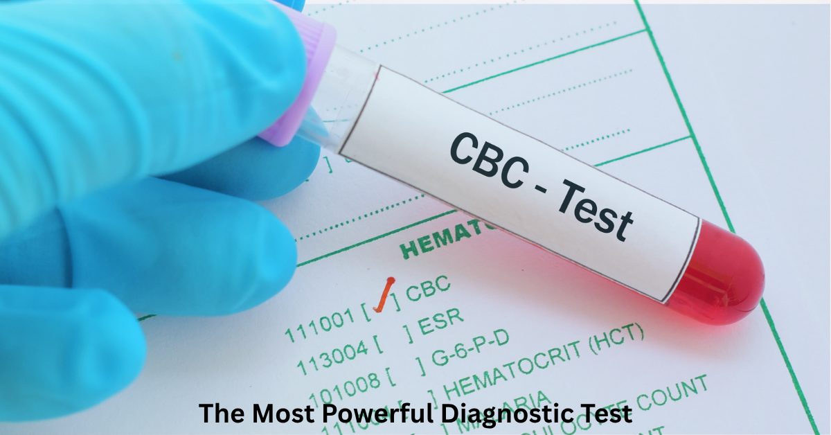 Why Do Doctors Prescribe a CBC Test? Lets Understand Its 24 Parameters