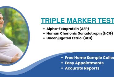 Triple Marker Test