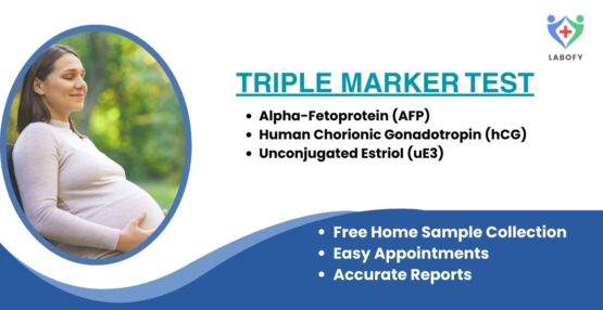 Triple Marker Test